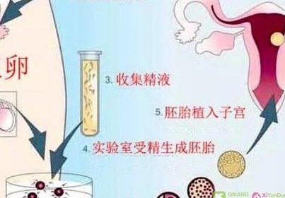 海安市生孩子做染色体检查有必要吗，筛查一次大概需要多少钱？