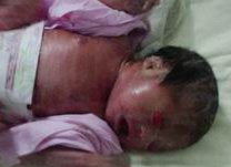 高龄做试管怀孕的几率有多高？高龄做试管需要做哪些检查？