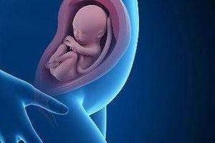 子宫肌瘤直接试管婴儿还是先手术治疗？听听好孕者怎么说